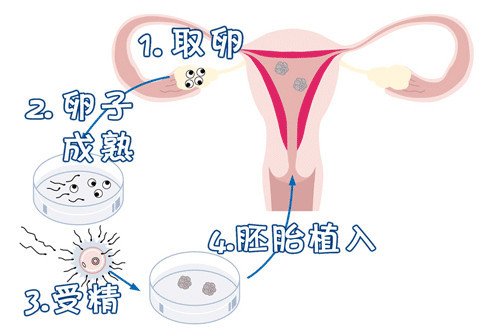 高齡二胎